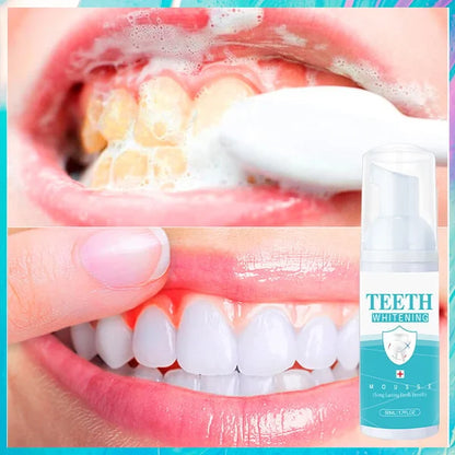 🎄 EARLY CHRISTMAS SALE 60% OFF🎁 TEETH WHITENING MOUSSE